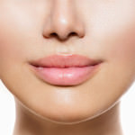 Lip Augmentation
