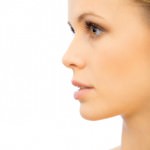 rhinoplasty